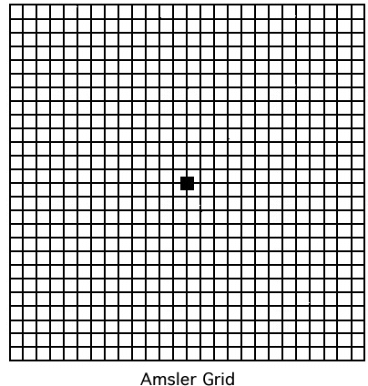 Grille d'Amsler